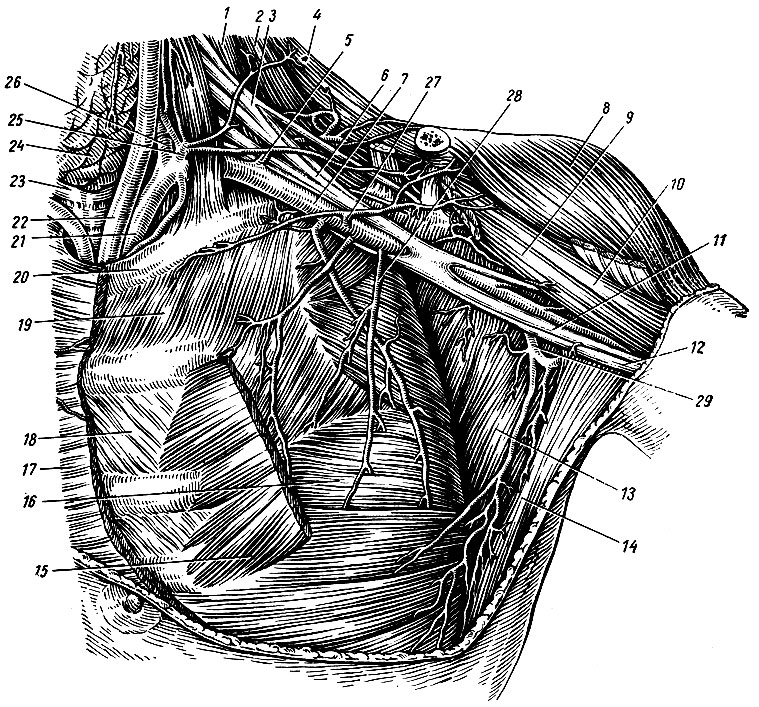 Рис. 164. Подключичная и подкрылыювая артерии. 1 - m. scalenus medius; 2 - m. levator scapulae; 3,6 - plexus brachialis; 4 - m. trapezius; 5 - a. transversa colli; 7 - a. axillaris; 8 - m. deltoideus; 9 - m. coracobrachial; 10 - m. biceps brachii (caput breve); 11 - n. medianus; 12 - n. ulnaris; 13 - m. subscapulars; 14 - m. latissimus dorsi; 15 - m. pectoralis minor; 16 - m. serratus anterior; 17 - m. pectoralis major; 18 - m. intercostalis internus; 19 - m. intercostalis externus; 20 - I ребро; 21 - a. subela via sinistra; 22 - a. carotis communis sinistra; 23 - trachea; 24 - glandula thyreoidea; 25 - truncus thyreocervicalis; 26 - a. vertebralis; 27 - a. thoracoacromial; 28 - a. thoracica lateralis; 29 - a. subscapularis