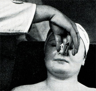 Рис. 335. . . . следует поворот кисти руки снизу вверх, причем пальцы проходят, гладя по ноздрям, вверх до корня носа?