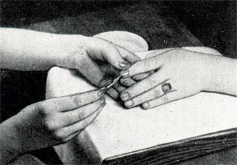 Рис. 395. Типичное положение руки при чистке ногтя