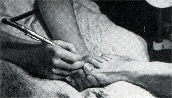 Рис. 414. Работа точечным фрезером